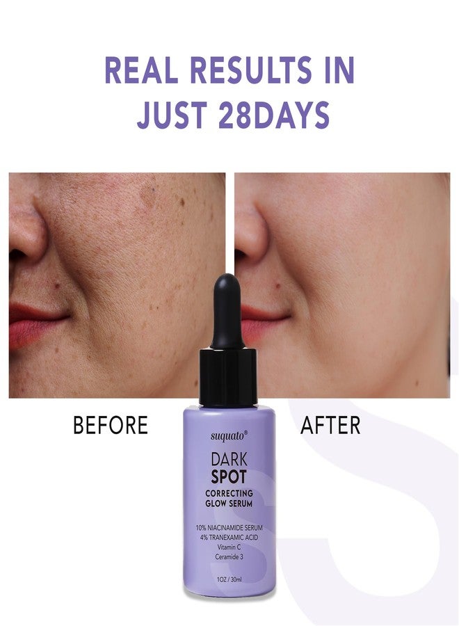 suquato Dark Spot Remover Serum – For Face Hyperpigmentation & Melasma Care – Brightening & Dark Spot Correcting Glow with Tranexamic Acid + Niacinamide + Vitamin C (30ml) - Image 4